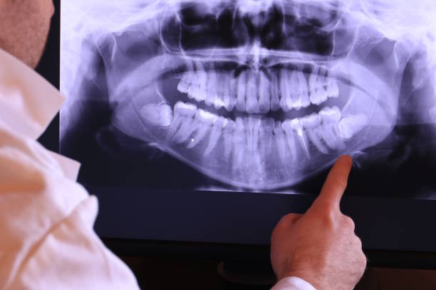 Best Dentist for Tooth Abscess  in Suquamish, WA